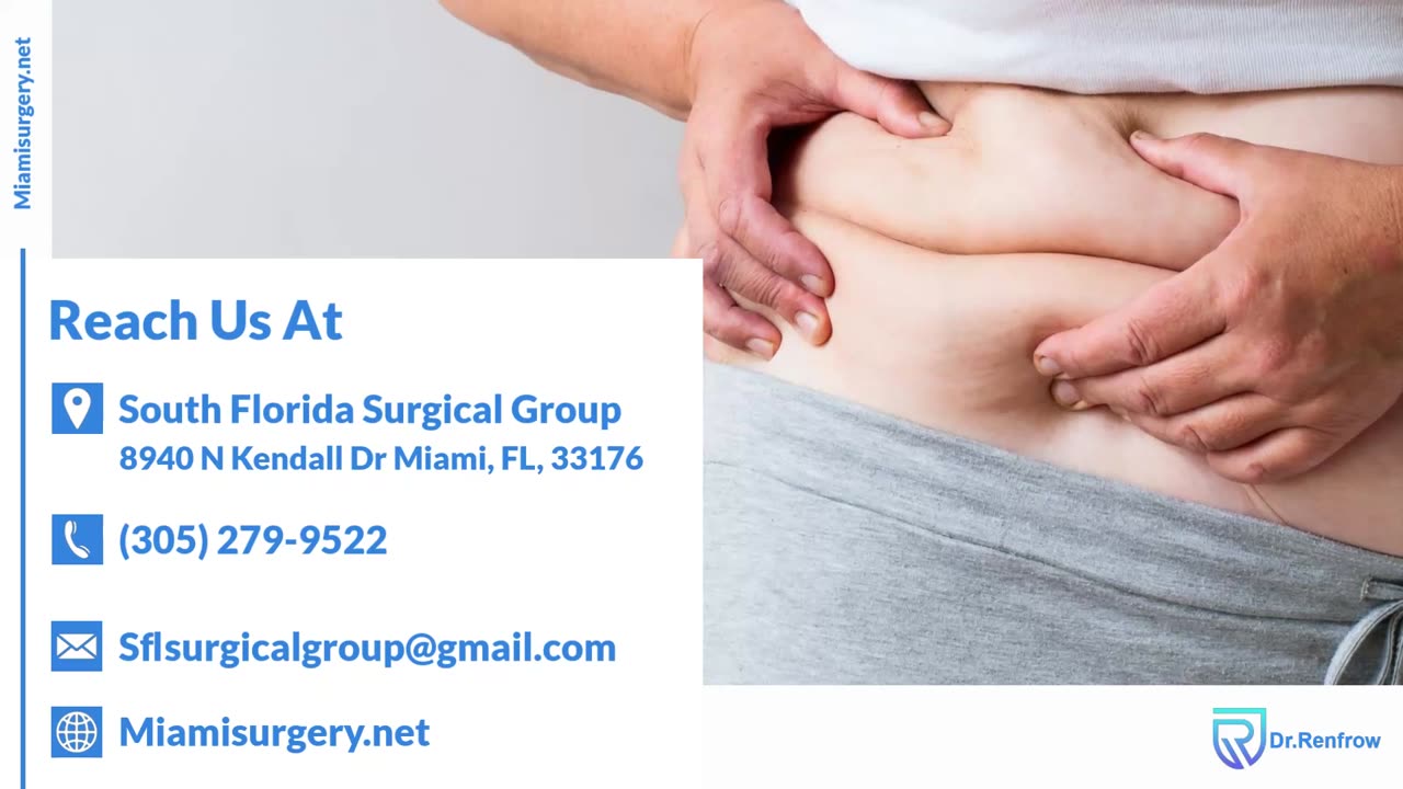 Are You a Candidate for Gastric Sleeve Surgery