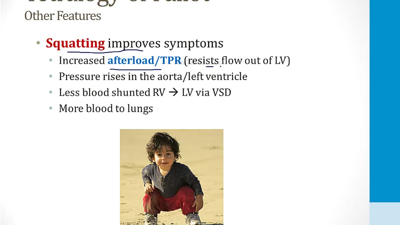 Cardiology - 7. The Developing Heart - 3.Cyanotic Congenital Heart Disease