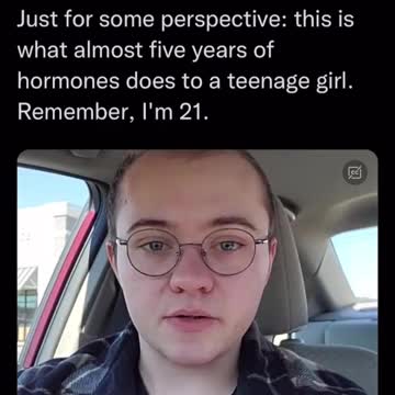 Hormones turn 16 year girl into 44 year old manqq