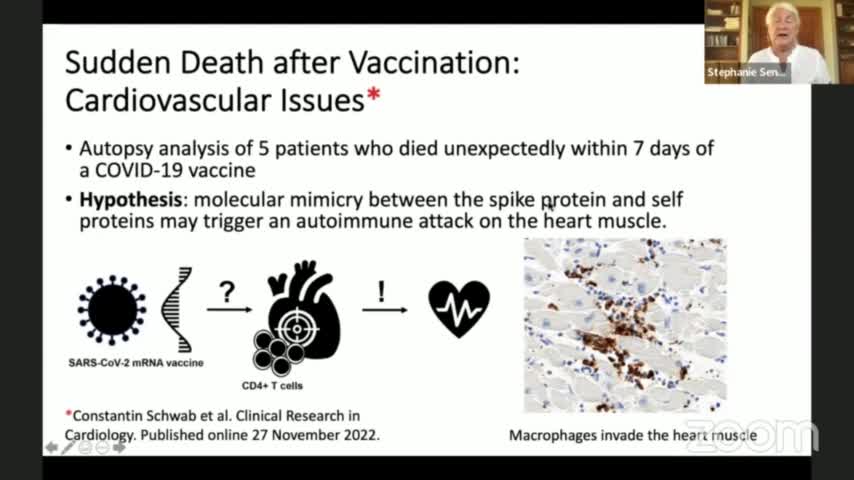 Cardiovascular Issues via Molecular Mimicry May Be What's to Blame for the Rise in Sudden Death