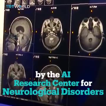 AI has matured to the point that it can out diagnose a room full of doctors! (TRT World).