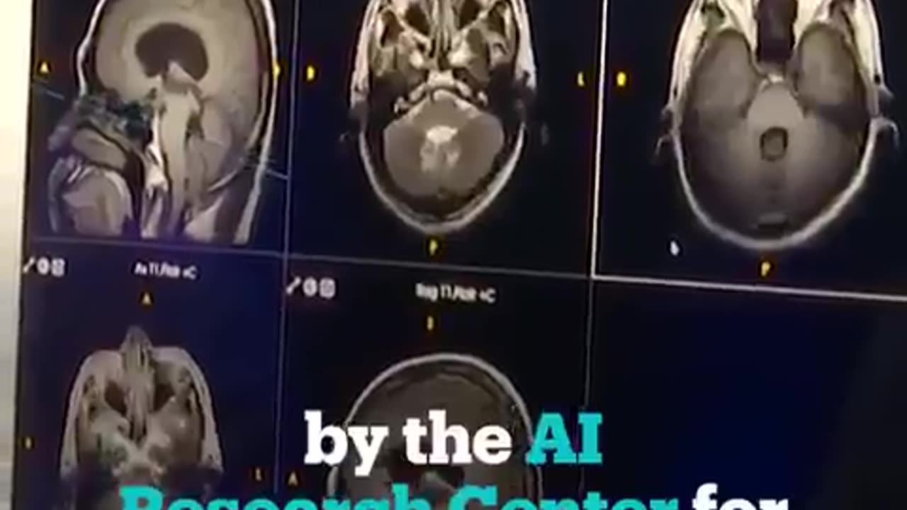 AI has matured to the point that it can out diagnose a room full of doctors! (TRT World).