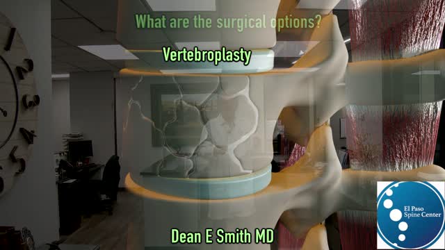 Should I have Surgery For My Compression Fracture ?