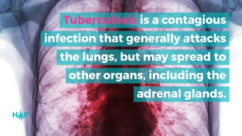 Causes Of Adrenal Insufficiency