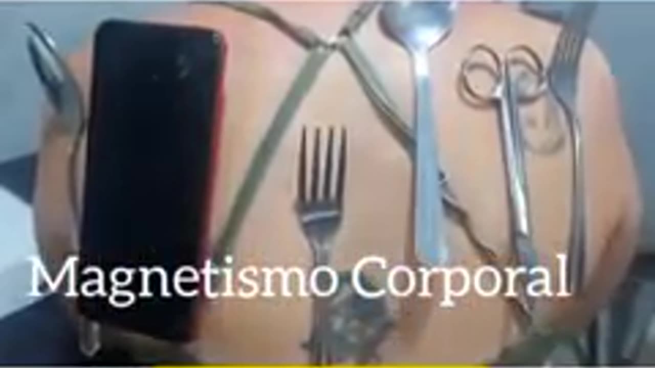 Vacunas lesiones graves, medico muestra y explica las consecuencias 19-COV