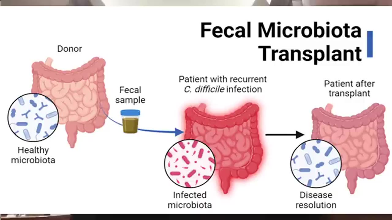 Dr. John Campbell - Faecal microbiome transfer