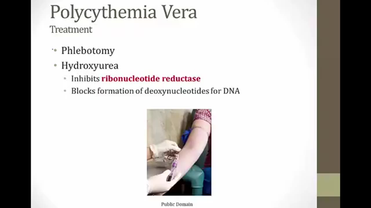 Myeloproliferative disorder bnb video