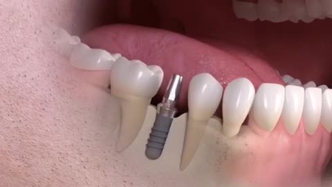 Dental Health Partner - Finding the Best Dentist in Sheffield!