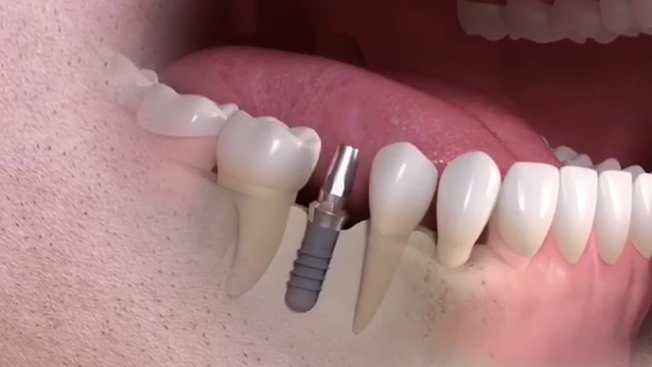 Dental Health Partner - Finding the Best Dentist in Sheffield!