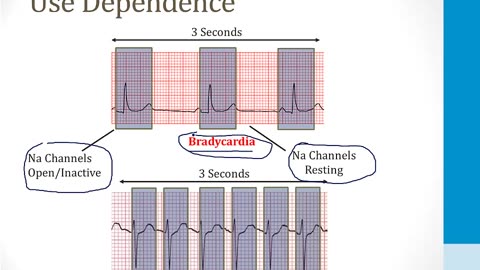 Cardiology - 4. Arrhythmias - 6.Antiarrhythmic Drugs