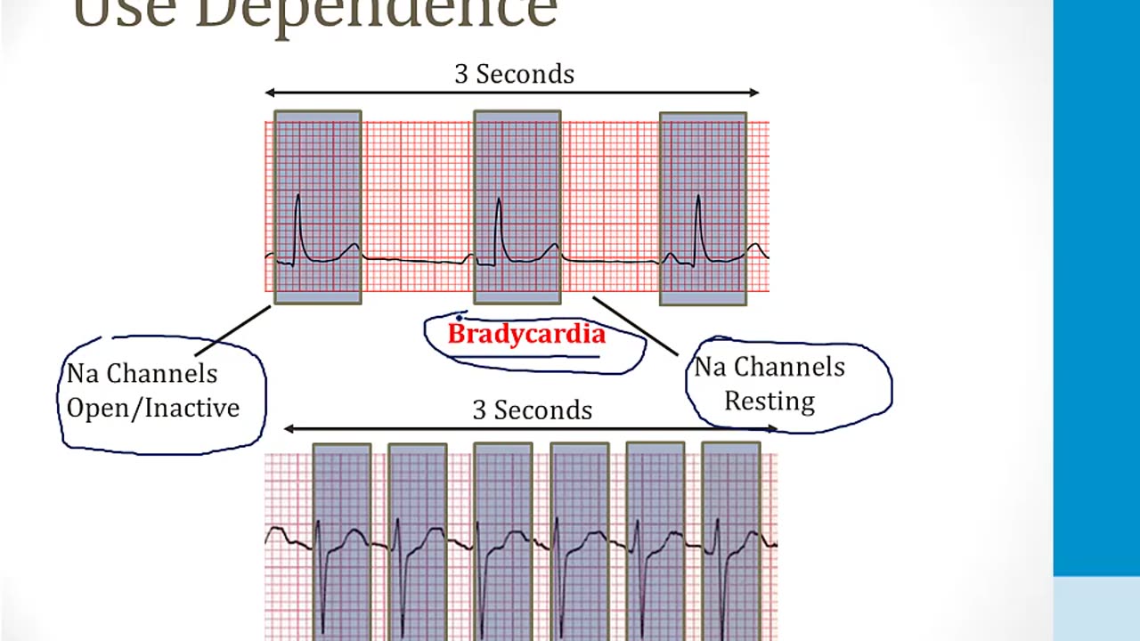 Cardiology - 4. Arrhythmias - 6.Antiarrhythmic Drugs