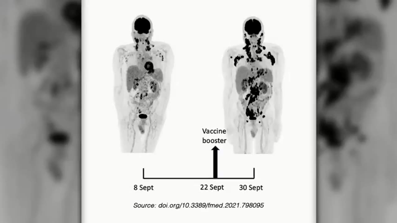 Why the vaccine NANOCAPSULES are prematurely failing.