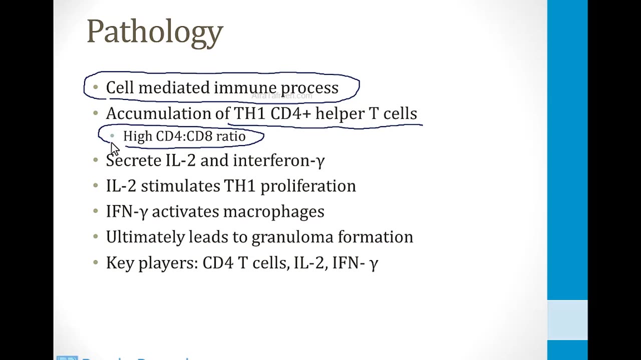 Pulmonary - 3. Other Pulmonary Topics - 7.Sarcoidosis