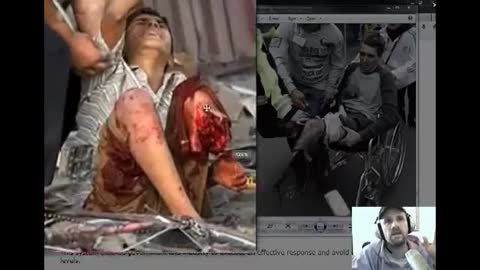 BOSTON MARATHON AMPUTEE ACTORS