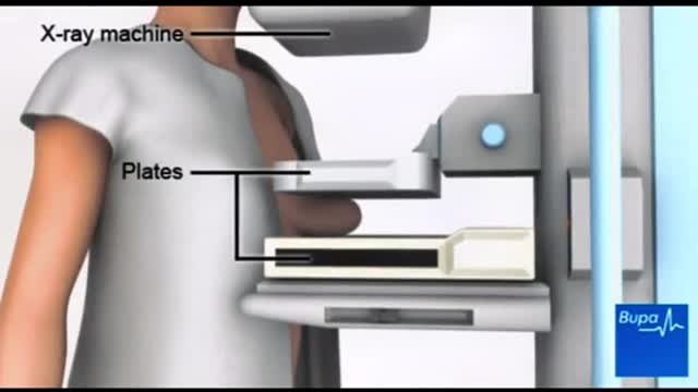 Mammography is the process of using low-energy X-rays to