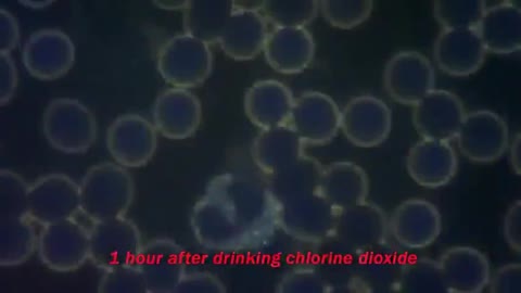 CI02:Chlorine Dioxide aka MMS/CDS and the Benefits when used to treat Disorders of Blood Viscosity