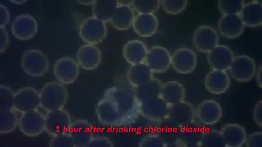 CI02:Chlorine Dioxide aka MMS/CDS and the Benefits when used to treat Disorders of Blood Viscosity