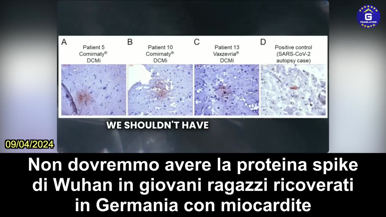 【IT】Dott. McCullough: Molte ricerche dimostrano che il vaccino COVID danneggia il cuore