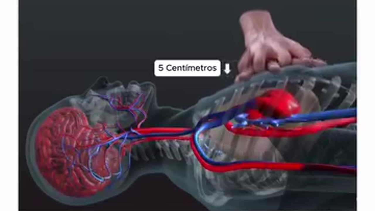 CPR Cardiopulmonary resuscitation