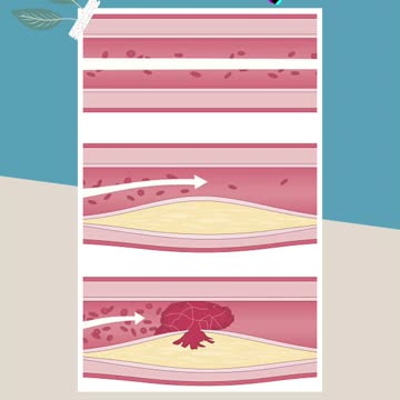 खून साफ कैसे करे |Blood purifier|Clear Skin