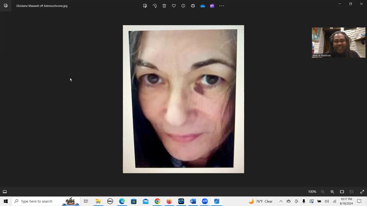 Covid, Monkey Pox, Bird Flu, Graphene Oxide, and Vaccine Hoax Update 8-18-2024