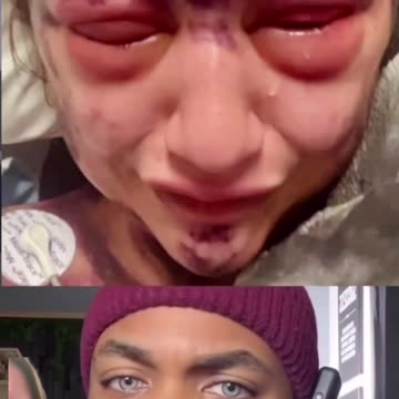 What The Darts Did To This Woman