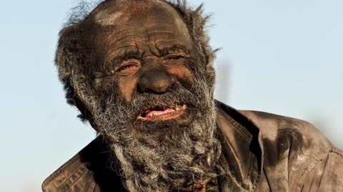 WORLDS DIRTIEST MAN NOT BATHED IN 60YEARS