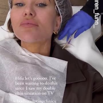 MAFS' Lauren Dunn gets a non-surgical face lift