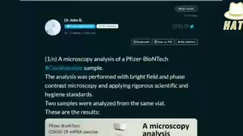 Microscopy of pfizer jab