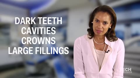 The best way to whiten teeth