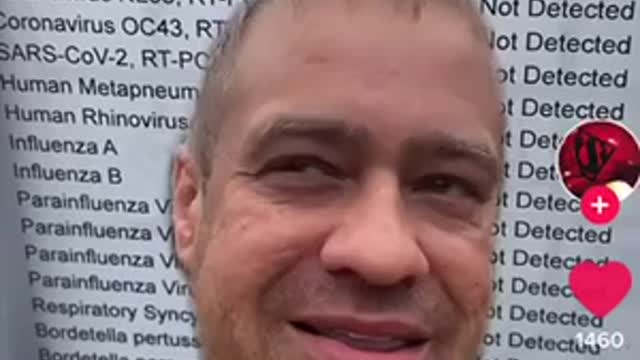 Corona virus 229E is the common cold