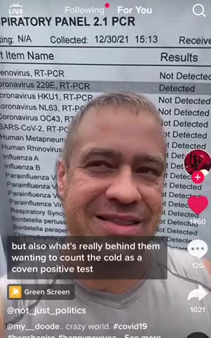 Corona virus 229E is the common cold