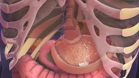 medical video