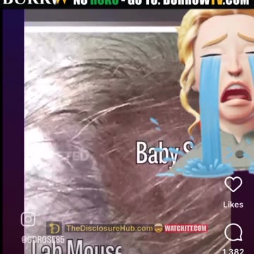 Aborted Baby Scalps are put on Rats... Approved by Dr Fauci...???