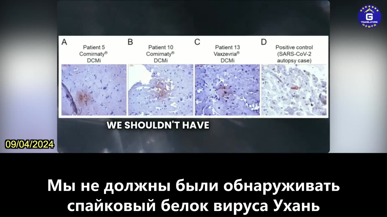 【RU】Доктор Маккалоу: Многие исследования показывают, что вакцина КОВИД наносит вред сердцу