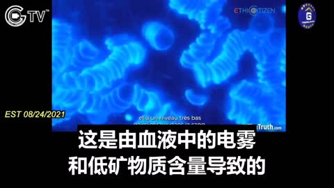 打新冠疫苗的紅血球黏成一串