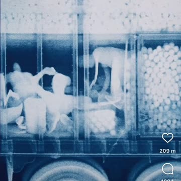 X-Ray taken by US-Mexico Border Patrol