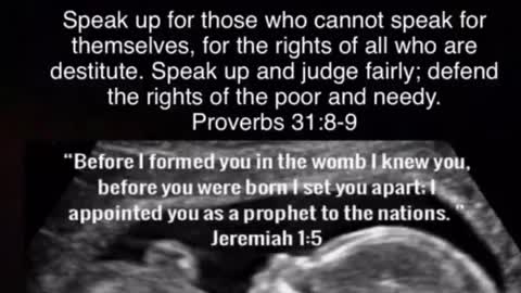 Human Life Is Priceless, At Any Stage