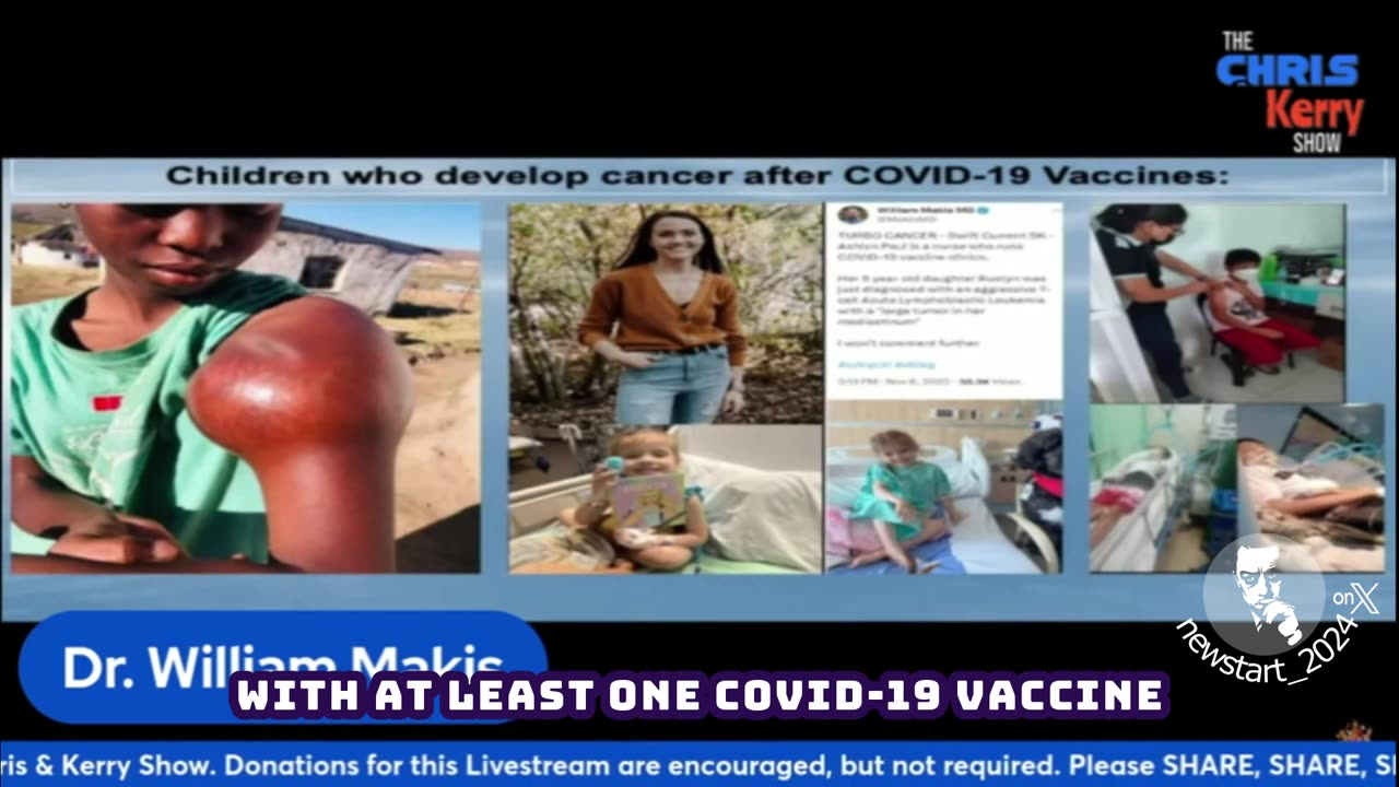 Covid-19 vaxxed kids have an elevated risk of cancer for the rest of their lives.