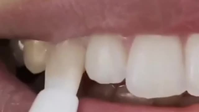 How Dentitox Unique Dental Works