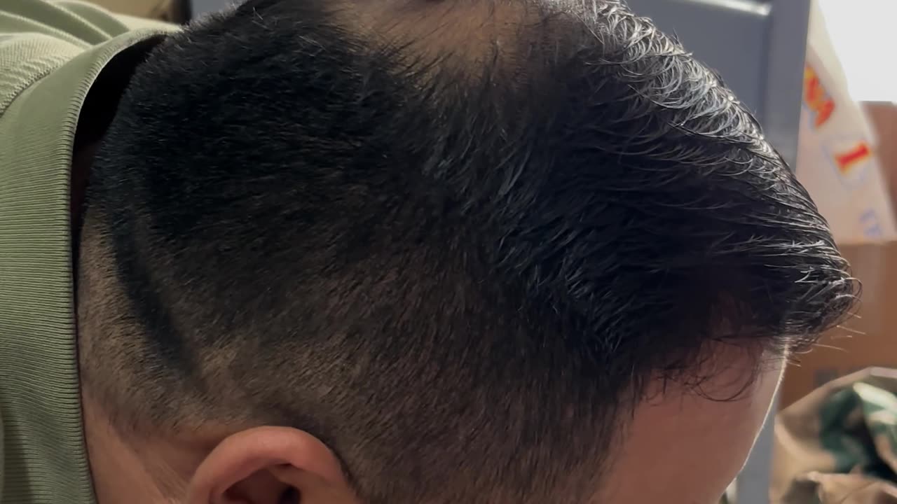 Top Spins On Balding Head