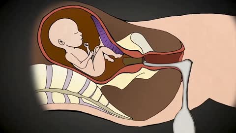 What do You Really Know About Abortion?