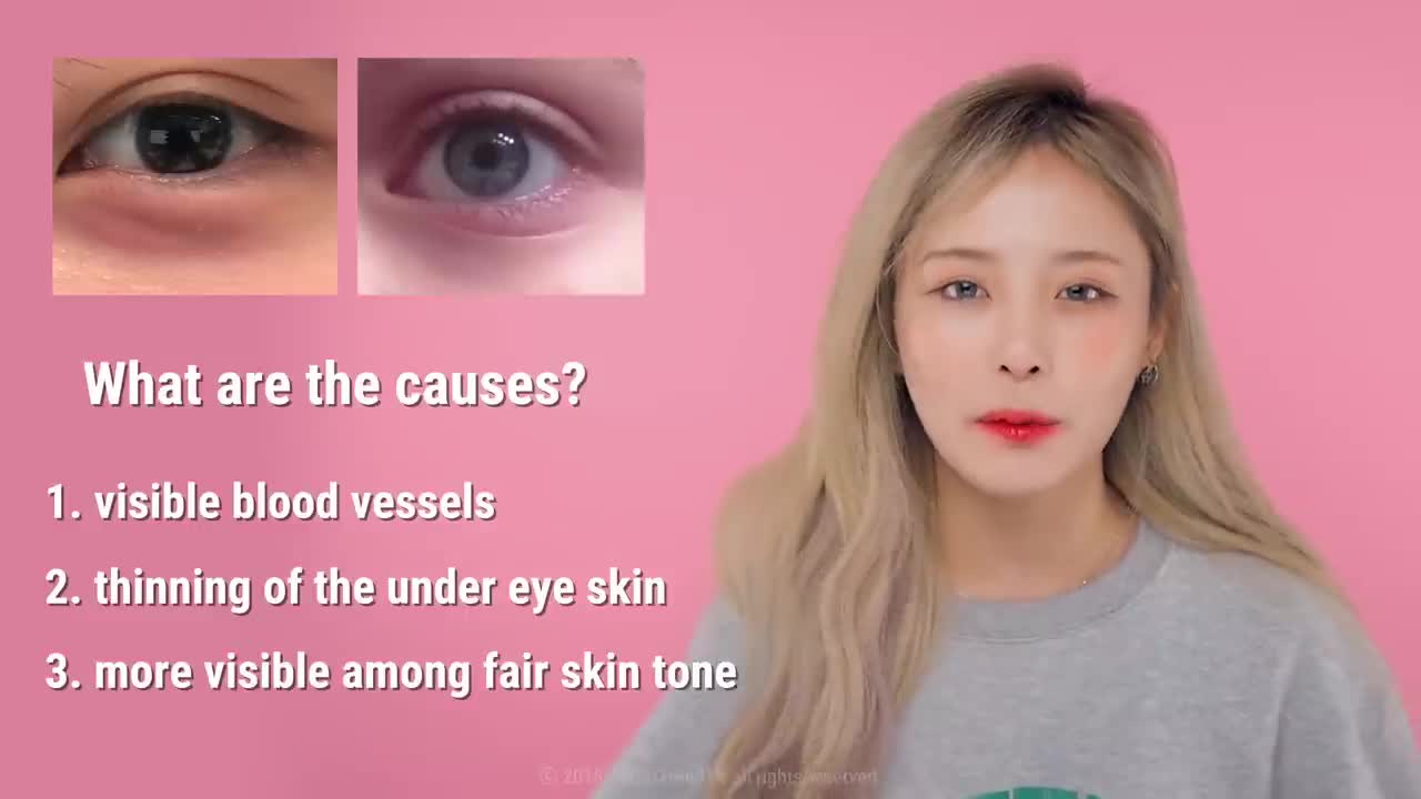 How to Remove Dark Circles Under Eyes In The Most Effective Way!