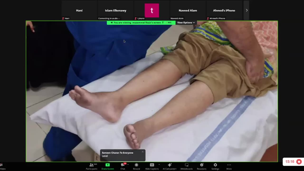 ST3.Examine the LL of this patient