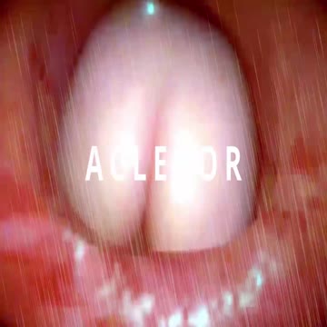 Acleror intro