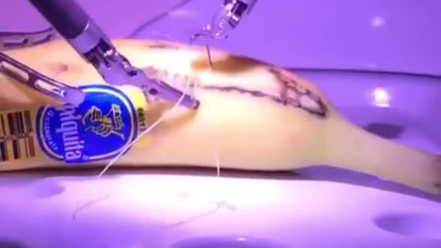 Banana surgery