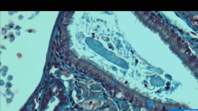 Stem Cell Documentary