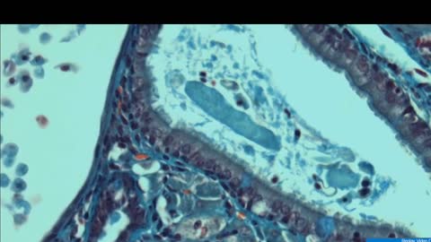 Stem Cell Documentary