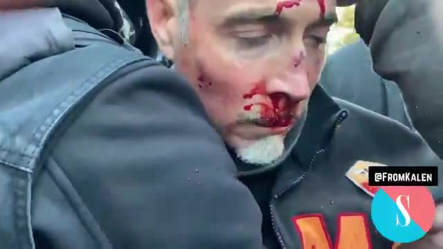 Trump Supporter Battered and Bloodied - Extra Footage