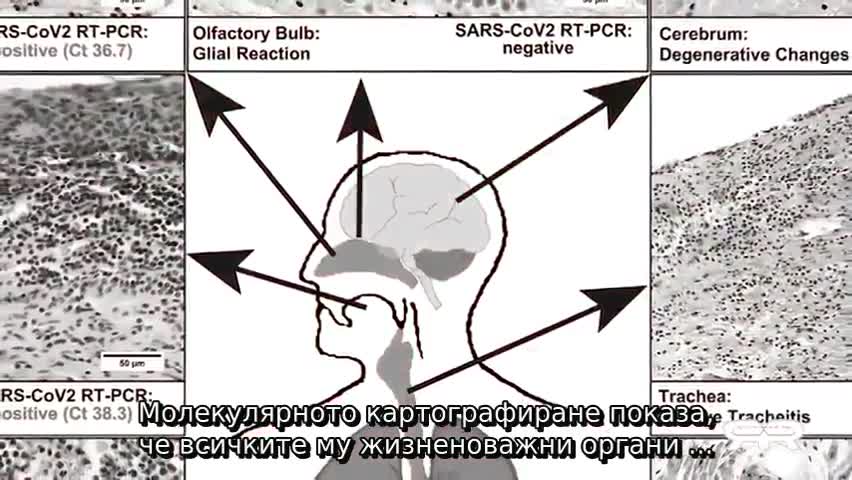 Пандемични измами ... Грег Рис